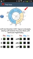 ECG practical Demo
