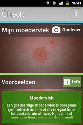 Huidmonitor