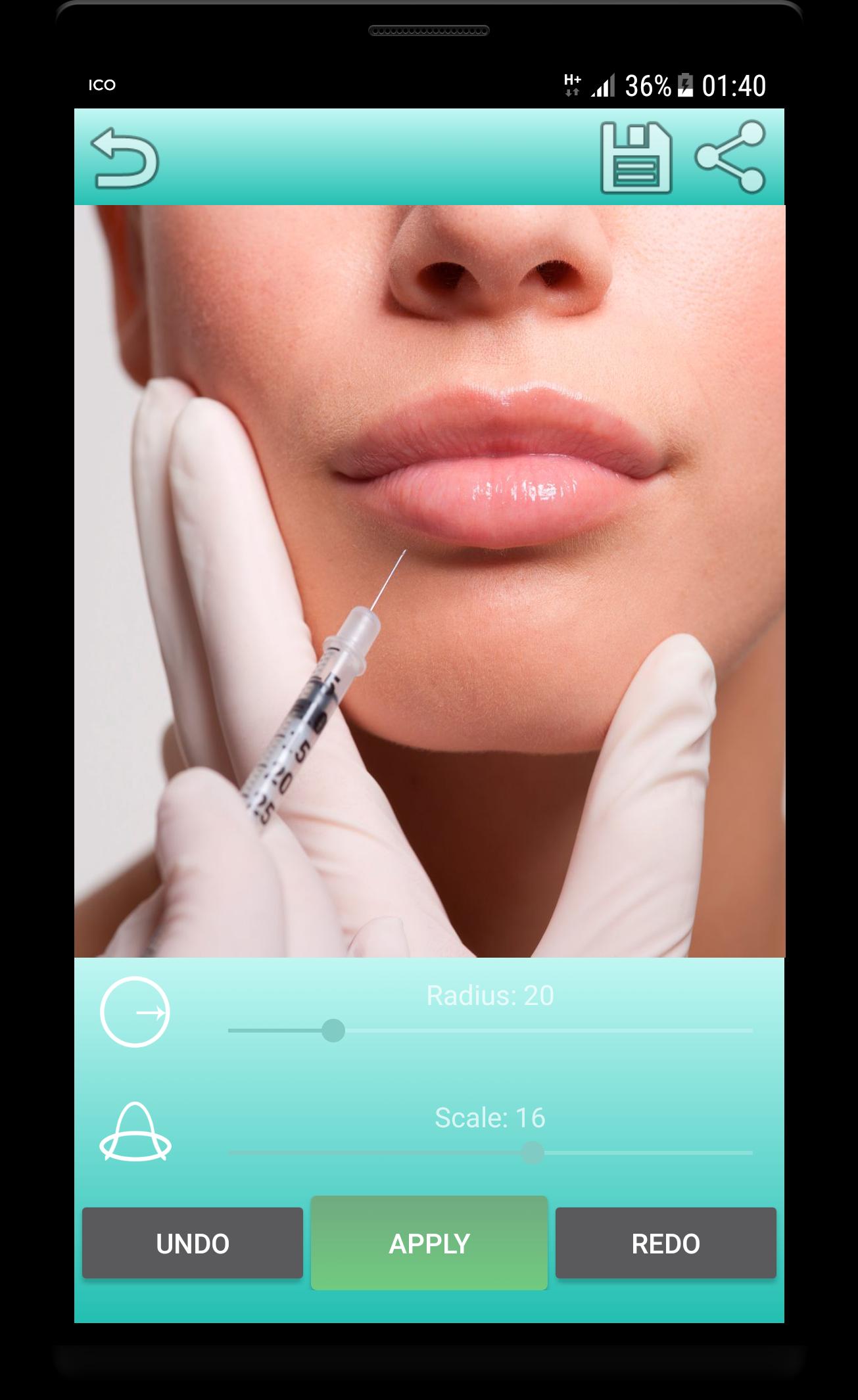 Botox Editor
