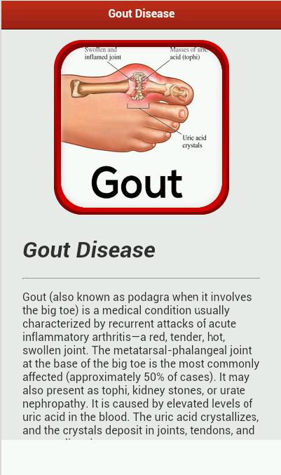 Gout Disease